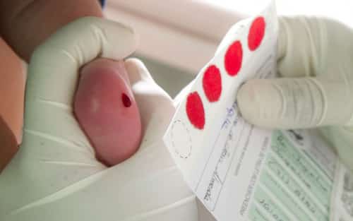 como-se-faz-o-teste-do-pezinho